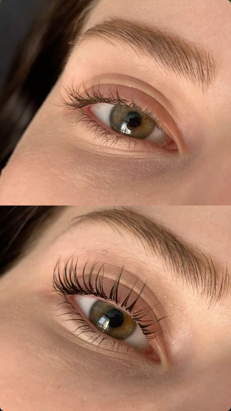 Wimpernlifting München — Vorher-Nachher am Auge