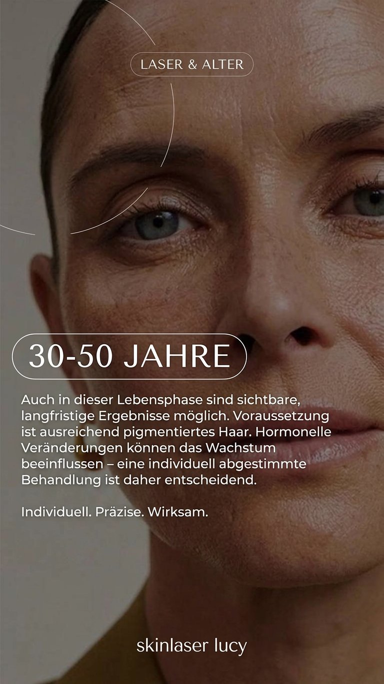 Laserhaarentfernung 30 bis 50 Jahre München – Skinlaser Lucy